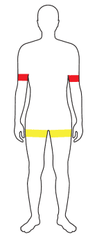 BFR Manschettenposition
